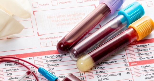 ヒトパピローマウイルスの血液検査